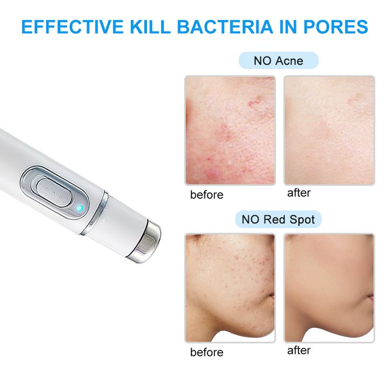 ACNE THERAPY LASER PEN