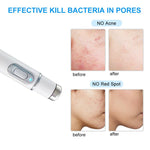 ACNE THERAPY LASER PEN